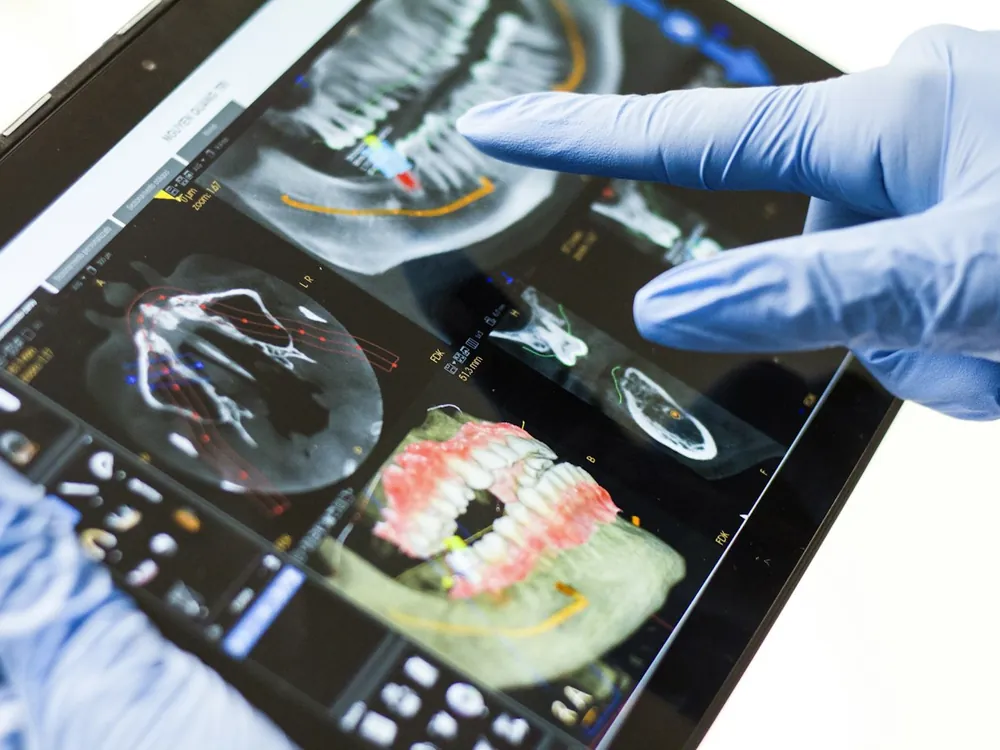 Tablette dijital diş taraması üzerinde çalışan hekim eli